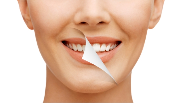 Shine Bright: Unveiling the Secrets of Teeth Whitening